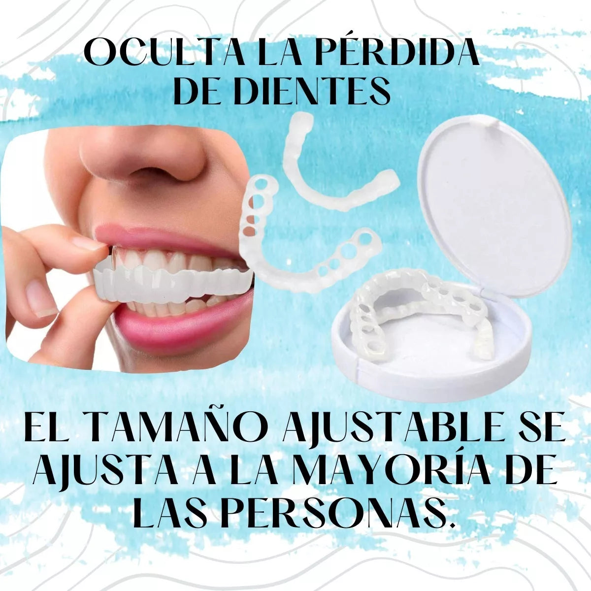 Carillas dentales Snap-on Smile